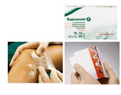 Medicazione sterile in film in poliuretano trasp. suprasorb f 10x12cm 10 pezzi